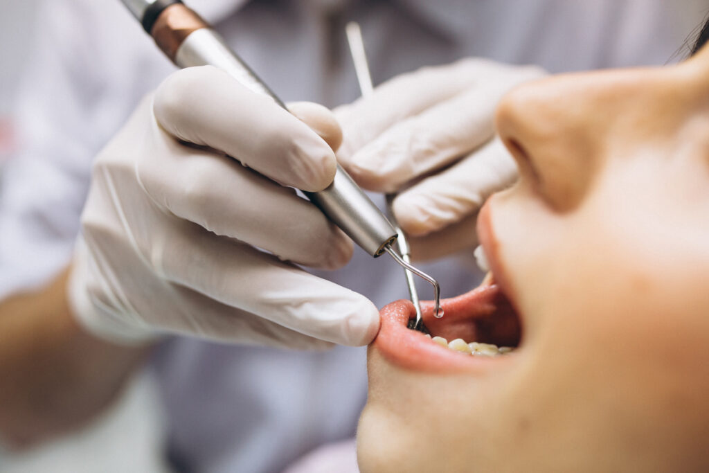 Mulher com a boca aberta passando por um procedimento com um dentista. Imagem ilustrando texto franquia odontológica.